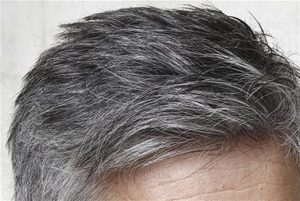 عوامل موثر در سفید شدن موها